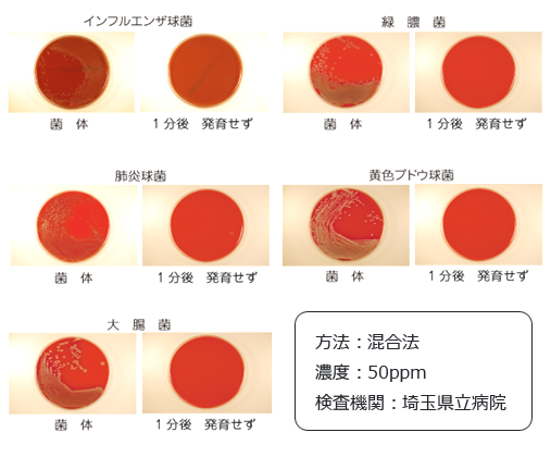 埼玉県立病院での検査